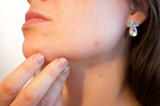 DERMATOLOGÍA PARA FARMACIAS